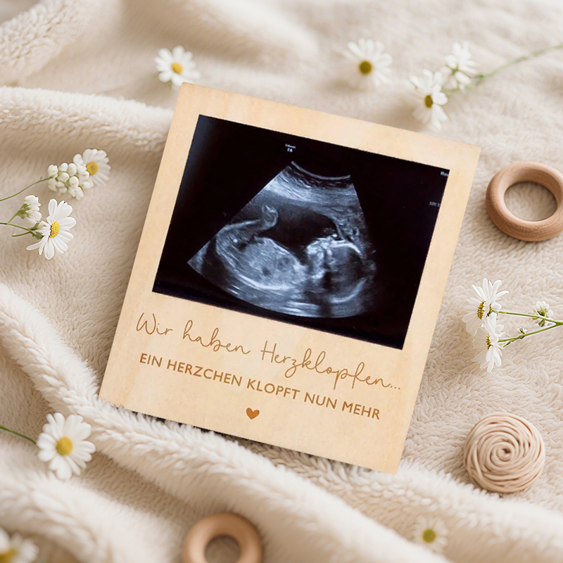 Ultraschall Schwangerschaft An – Photo Booth Frame Bewertung und Preis